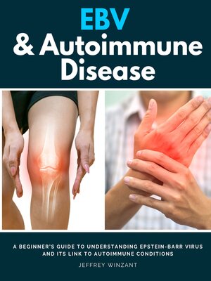 cover image of EBV & Autoimmune Disease